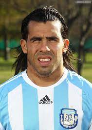 It was incredible. story behind carlos tevez neck scar: Pf Transfer News On Twitter Carlos Tevez S Scars On His Neck Were A Result Of A 3rd Degree Burn After Being Scalded With Boiling Water As A Kid Http T Co Crbry09vpb