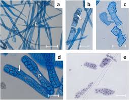 Image result for Isoberlinia angolensis