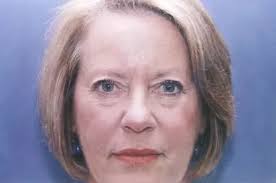 Eyelid Surgery Case 3