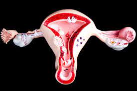 Adenomyosis And Fertility Howstuffworks