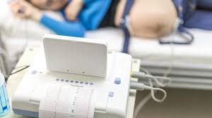 Denn mit einer ctg lassen sich notfall oder gefahrenzustände des ungeborenen feststellen und kontrollieren. Ctg Wehenschreiber Was Die 5 Linien Bedeuten Hallo Eltern