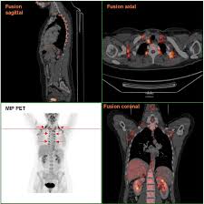 How Much Does Pet Scan Cost Near Me Affordablescan