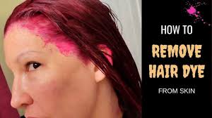 Choosing the right hair dye can go a long way towards not needing to scramble to fix your color in. How To Remove Hair Dye Stain From Skin Instantly Fastest Way To Get Hair Dye Off Skin Youtube
