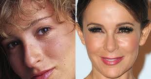 Plastic surgeries are becoming more and more common throughout the country. Celebrity Plastic Surgery Disasters Cbs News