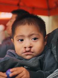 100 Kids Smile For The First Time