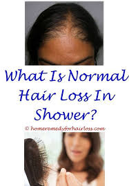 Pin On Hair Loss