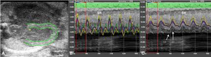 Gi god hlr i 3 min. Fetal Echocardiography And Pulsed Wave Doppler Ultrasound In A Rabbit Model Of Intrauterine Growth Restriction Protocol Translated To Norwegian