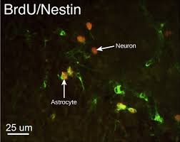 Check spelling or type a new query. Biology Animal Structure And Function The Nervous System Neurons And Glial Cells Oer Commons