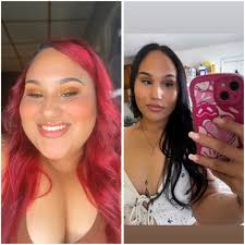 Weight loss journey after gastric sleeve surgery