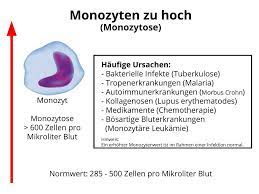 Monozyten Zu Hoch Monozytose Ursachen