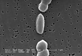 We did not find results for: Vibrio Parahaemolyticus Wikipedia Bahasa Indonesia Ensiklopedia Bebas