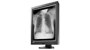 Kontrastvæske brukes hyppig for å fremheve ett organ eller for bedre å skille frisk og sykt vev fra hverandre. Radiforce Gx340 3 Mp Befundungsmonitor Graustufen