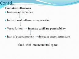 Pleural Effusion