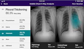 Open your phone's photos app. Mobile Chest X Ray Analysis Microsoft Garage
