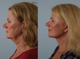 Best Plastic Surgery NJ