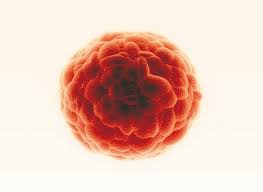 Signs and symptoms of mesothelioma may. Cancer Stem Cells What You Should Know Promocell