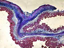 Darmentzundung Colitis Ulcerosa Neue Therapien Verbessern Lebensqualitat Der Spiegel