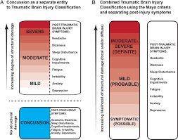 Concussion Is Confusing Us All Practical Neurology