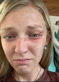 acting like a victim in family situations