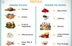 Fistula Diet After Fistula Surgery