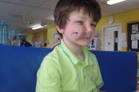 Young boy has dangerous toxins injected into his face to reduce 'massive  growth'