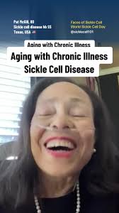 80 years old with #sicklecell disease! 🥹 We’re starting  #WorldSickleCellDay off with our first #FacesofSickleCell feature, Pat  McGill. When we say she is an absolute gem… Life expectancy for sickle ...