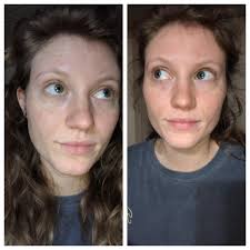 Night oil results after consistent use