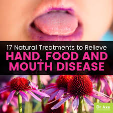 Hand Foot And Mouth Disease 17 Natural Treatments Dr Axe