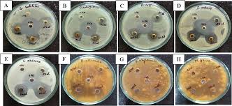 Image result for Ixora brachypoda