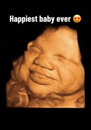 Baby 64 Ultrasound Brooklyn Joy Mayberry