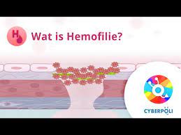 `de betekenis van een woord of een uitdrukking`, `de. Wat Is Hemofilie Youtube