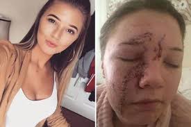It feels like my life is over' says 22-year-old woman glassed in the face