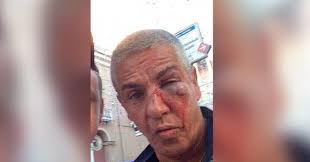 Samy_nacerioff tarka.boris@gmail.com contac maroc berkaouimouna@gmail.com. Sami Naceri Le Visage Tumefie Apres Une Altercation Dans Un Bar L Acteur Dement Les Informations Des Medias Russes
