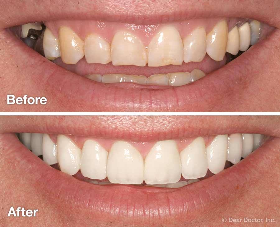 Smile Designing in Siliguri product image