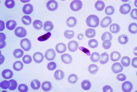 Not a malaria virus i accidentally added virus. Plasmodium Falciparum Wikipedia