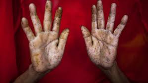 Image result for Arsenic