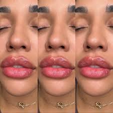 𝑴𝒂𝒕𝒖𝒓𝒆 𝒍𝒊𝒑𝒔 𝒕𝒐 𝒑𝒆𝒓𝒇𝒆𝒄𝒕𝒊𝒐𝒏 💗 0.5 cc of lip filler 💋 Mayra  Gamboa BSN , RN ✨ To book click the link in my bio ✨ @chamataplasticsurgery  #woodlandsinjector #houstoninjector #nurseinjector #myevergreenmedspa  #restylane #