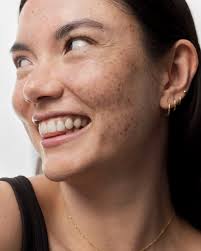 grantcuratola) • Instagram photos and videos