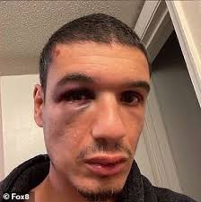 North Carolina pizzeria owner knocked unconscious, stomped