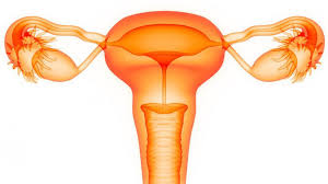 With severe disease, you'd have many deep endo implants as well as significant scarring and large cysts on one or both ovaries. How To Improve Your Uterine Lining To Prepare For Ivf Lane Fertility Institute Fertility Specialists