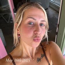 OKAYYY SKIN ✨ (this is gonna be a long one) Some of you know, most of you  don't but the past 7 months I've been dealing with the worst acne  experience since