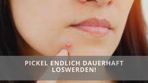 Stress, hormone und bestimmte medikamente können das pickelrisiko erhöhen und die pickel oder akne verschlimmern. Sicher Kennst Du Den Moment Schon Wieder Ein Neuer Pickel Mit Diesen Einfachen Tipps Kannst Du Die Entstehu Tipps Gegen Pickel Pickel Blaschen Auf Der Lippe