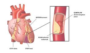 Kondisi ini dapat menyebabkan masalah pada ibu maupun bayinya jika tidak diobati. Diabetes Kardio Berkait Rapat