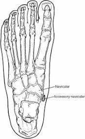 Foot Deformities In Ct What Is That Extra Bone In My Foot Foot Deformities Eye Facts Bone Tattoos