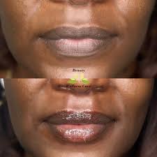 Beauty & Wellness Care (@beautywellnesscaregvl) • Instagram photos and  videos