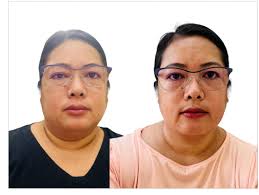 Intermittent Fasting For Women In Their 40's... 50's... And Beyond!