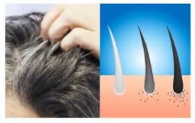A risolvere quello che da molti anni. Grayout Con Melatine Per Eliminare I Capelli Bianchi Funziona Opinioni E Prezzo Ricrescitacapelli24 Com