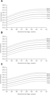 Revisiting Head Circumference Of Brazilian Newborns In