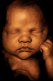 Hello I am wondering how much hope I have of my little lady growing.  Measured today as 12.1 and a half. Dam is roughly 13.2hh section C and Sire  14.3hh section D