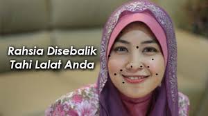 Rahsia Tahi Lalat Anda Mesti Ramai Yang X Tau Kan